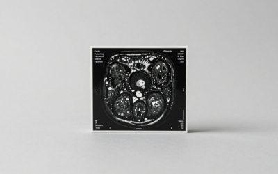 Best Mri All in One in 2026: How the Top Models Compare